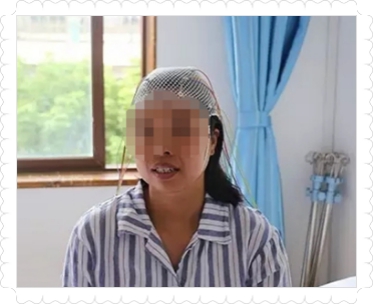导致女性患上癫痫的原因主要有哪些